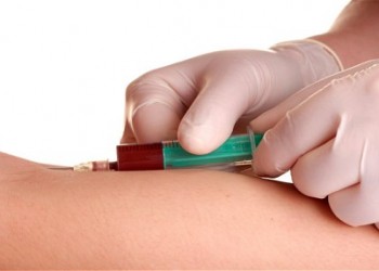 Wings Forensic medicine Steadily Analize de sânge pentru bolile autoimune (analize autoimunitate) | Speciale | Analize Wings Forensic medicine Steadily Analize de sânge pentru bolile autoimune (analize autoimunitate) | Speciale | Analize