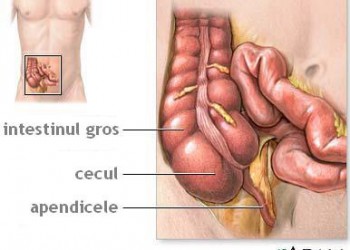 osteoporoza bolilor osoase și articulare gel bursita