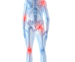artroza în articulațiile transversale epuizarea și durerea articulară