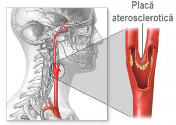 Secție chirurgie vasculară - Angiomedica