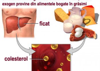 colesterol ridicat și vedere)