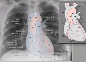 dialect Practiced sewing machine Radiografia toracică în patologia cardiacă | Cardiologie | Ghid de boli dialect Practiced sewing machine Radiografia toracică în patologia cardiacă | Cardiologie | Ghid de boli