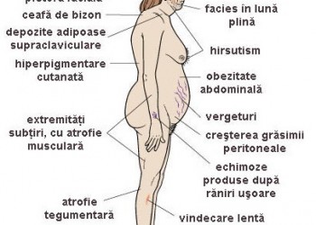 cortizol scazut simptome