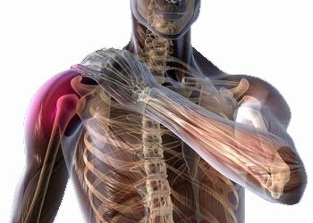 consecințele artrozei articulației cotului