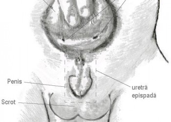 temperatura poate fi cu prostatita cancer de prostata estadio 1