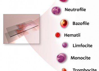 diagrama de helmint și trombocite)