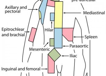 Ganglionii limfatici măriți ai mediastinului și dureri articulare