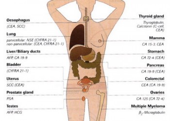 PSA (Antigen Specific Prostatic) | Centru Oncologie Severin