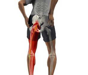 atrăgând durerea de la fese la spatele genunchiului osteoartrita de gradul 4 a soldului