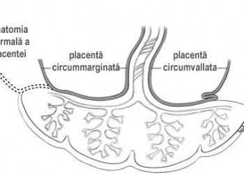 Grad de maturare placenta