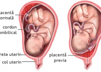 Placenta