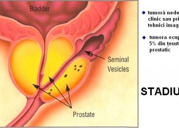 Dimensiuni normale prostată