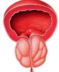 adenom de prostată și diferență de prostată