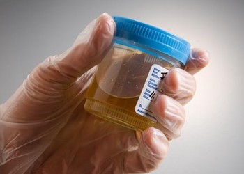 mucusul prostatitei în urină