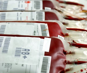 Blueprint suddenly freezer Transfuzia de sânge | Hematologie | Ghid de boli