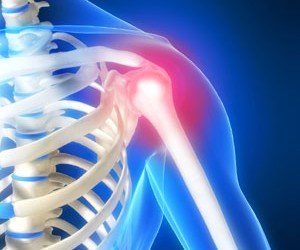 deformarea osteoporozei tratamentului articulației umărului
