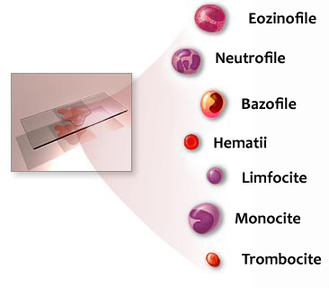 Trombocitele sunt crescute în varicoză