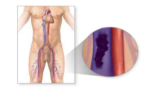 anatomy blood clotting anatomy blood clotting